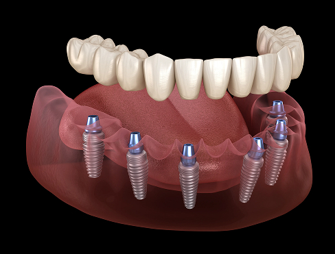 Teeth images